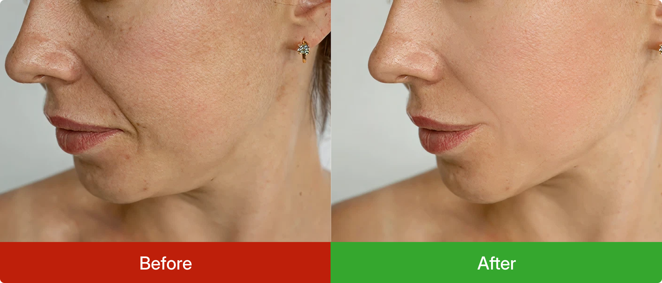 Biolgical lymphatic system cleanse review