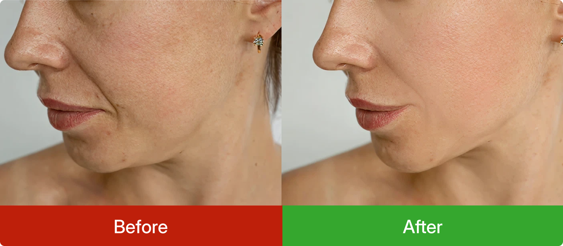 Before and after comparison of a woman's face with visible skin texture differences.