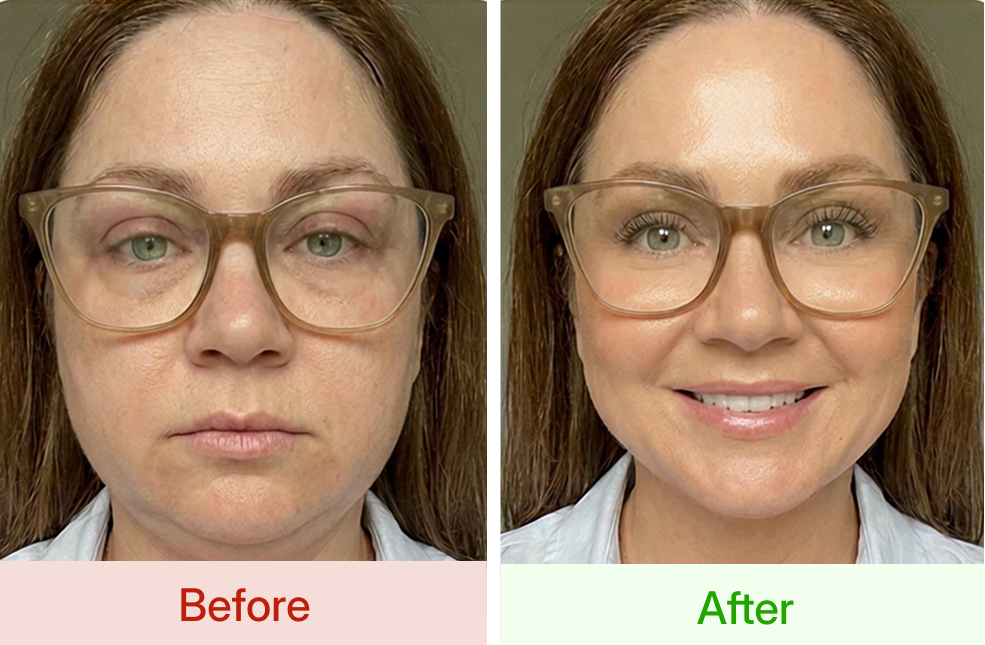 lymph drainage supplement