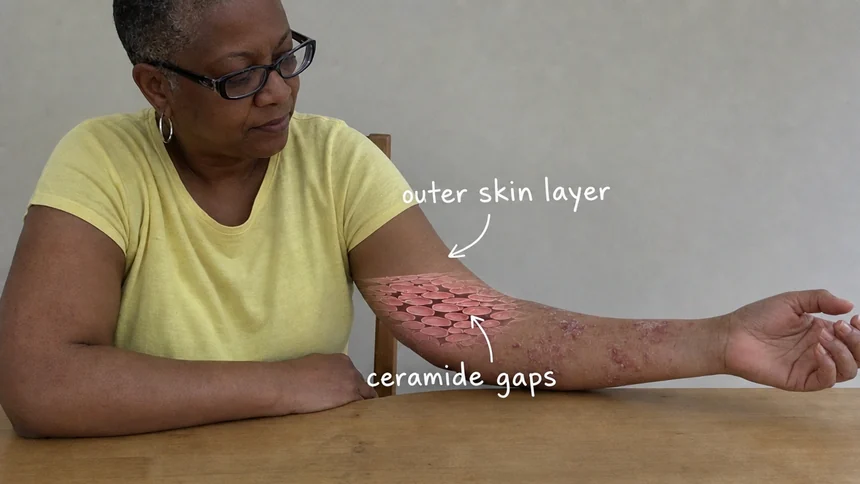 A woman's inner forearm with the skin's outer layer magnified inside it, two labels naming the tiled skin cells and the ceramide gaps between them