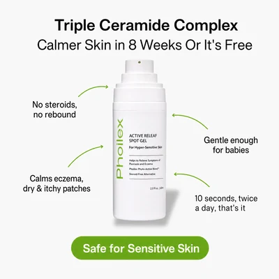 Active ReLeaf Spot Gel - Phoilex